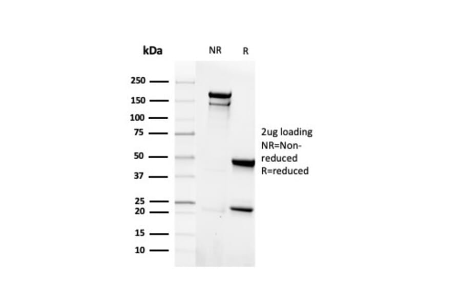 SDS-PAGE - Anti-EpCAM Antibody [rEGP40/4547] - BSA and Azide free (A249256) - Antibodies.com