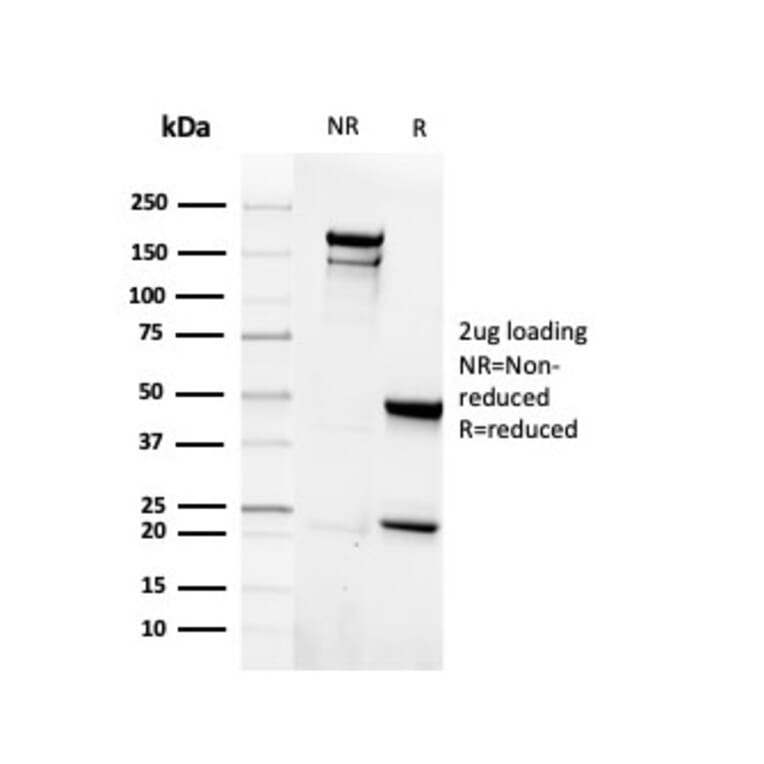 SDS-PAGE - Anti-EpCAM Antibody [rEGP40/4547] - BSA and Azide free (A249256) - Antibodies.com