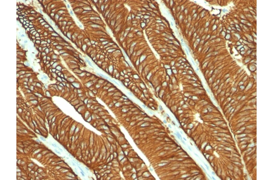 Immunohistochemistry - Anti-EpCAM Antibody [MOC-31] - BSA and Azide free (A252436) - Antibodies.com
