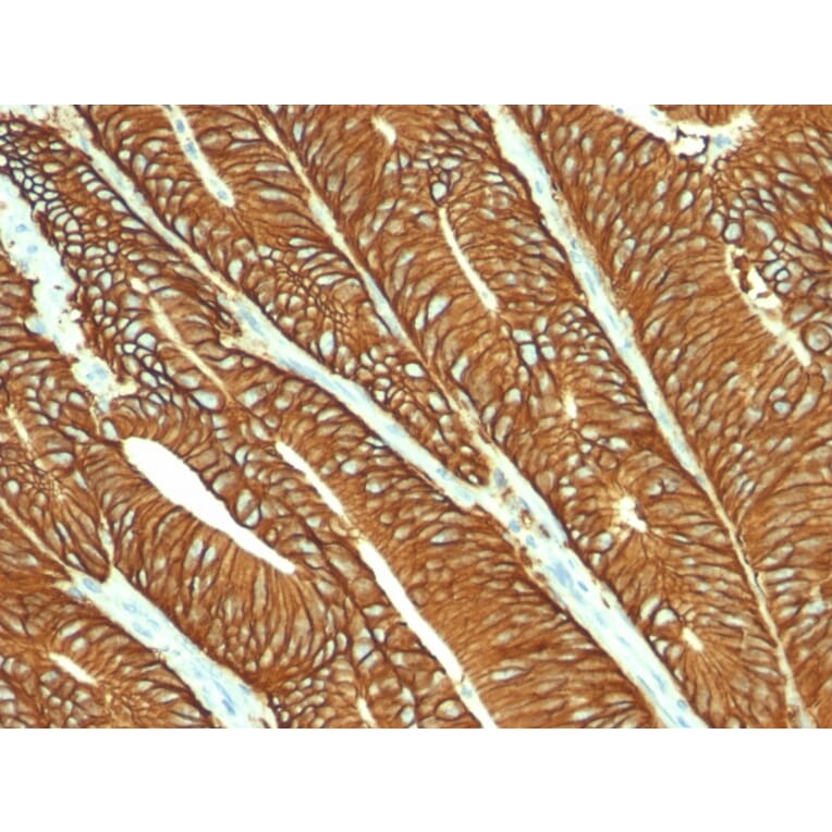 Immunohistochemistry - Anti-EpCAM Antibody [MOC-31] - BSA and Azide free (A252436) - Antibodies.com