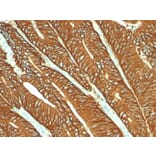 Immunohistochemistry - Anti-EpCAM Antibody [MOC-31] - BSA and Azide free (A252436) - Antibodies.com