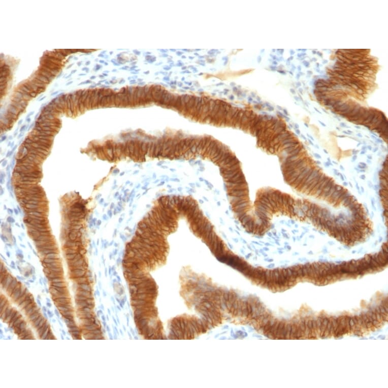 Immunohistochemistry - Anti-EpCAM Antibody [MOC-31] - BSA and Azide free (A252437) - Antibodies.com