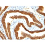 Immunohistochemistry - Anti-EpCAM Antibody [MOC-31] - BSA and Azide free (A252437) - Antibodies.com