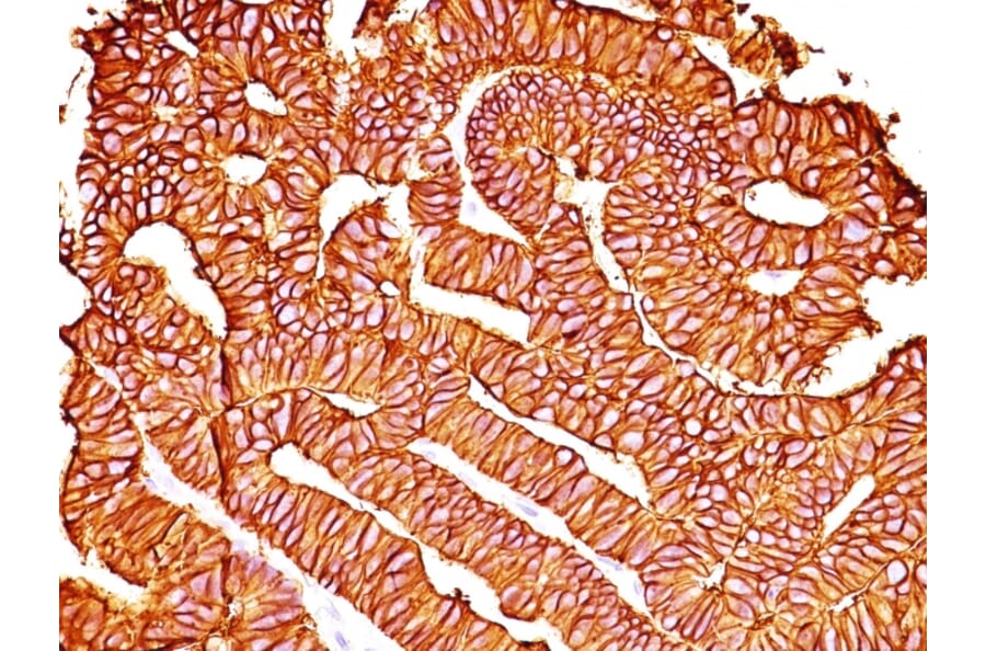 Immunohistochemistry - Anti-EpCAM Antibody [SPM528] - BSA and Azide free (A252437) - Antibodies.com