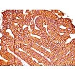 Immunohistochemistry - Anti-EpCAM Antibody [SPM528] - BSA and Azide free (A252437) - Antibodies.com
