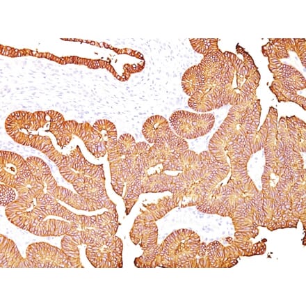 Immunohistochemistry - Anti-EpCAM Antibody [323/A3] - BSA and Azide free (A252439) - Antibodies.com