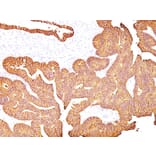 Immunohistochemistry - Anti-EpCAM Antibody [323/A3] - BSA and Azide free (A252439) - Antibodies.com