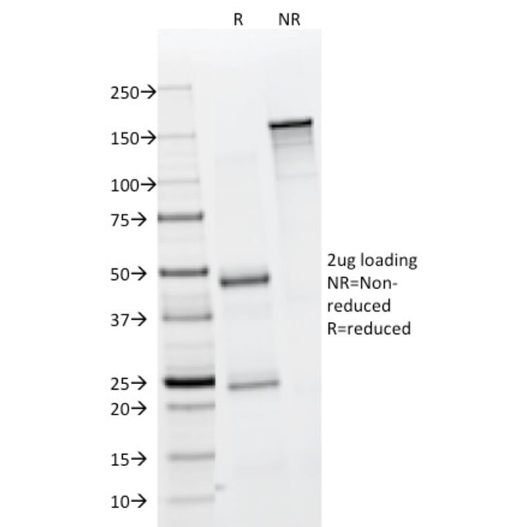 SDS-PAGE - Anti-EpCAM Antibody [323/A3] - BSA and Azide free (A252439) - Antibodies.com