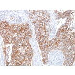 Immunohistochemistry - Anti-EpCAM Antibody [HEA125] - BSA and Azide free (A252440) - Antibodies.com