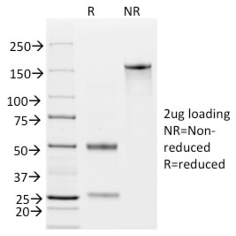 SDS-PAGE - Anti-EpCAM Antibody [EGP40/826] - BSA and Azide free (A252441) - Antibodies.com