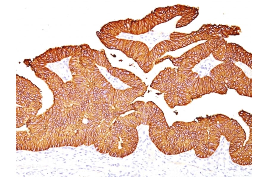 Immunohistochemistry - Anti-EpCAM Antibody [EGP40/837] - BSA and Azide free (A252442) - Antibodies.com