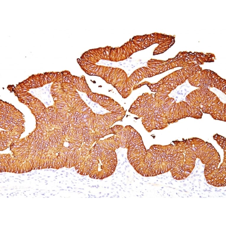 Immunohistochemistry - Anti-EpCAM Antibody [EGP40/837] - BSA and Azide free (A252442) - Antibodies.com