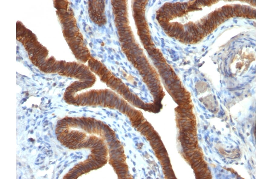 Immunohistochemistry - Anti-EpCAM Antibody [EGP40/837] - BSA and Azide free (A252442) - Antibodies.com