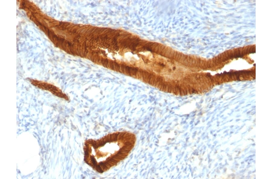 Immunohistochemistry - Anti-EpCAM Antibody [EGP40/837] - BSA and Azide free (A252442) - Antibodies.com
