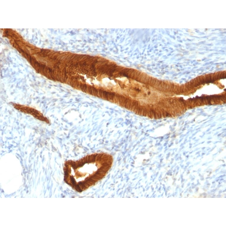 Immunohistochemistry - Anti-EpCAM Antibody [EGP40/837] - BSA and Azide free (A252442) - Antibodies.com