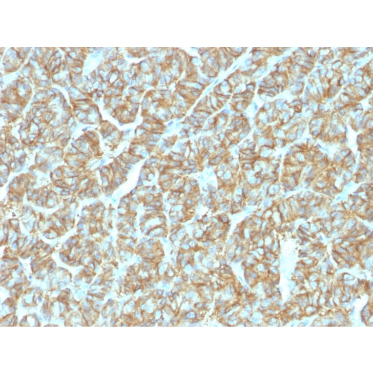 Immunohistochemistry - Anti-EpCAM Antibody [EGP40/1555R] - BSA and Azide free (A249264) - Antibodies.com