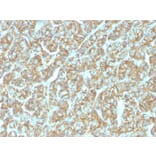 Immunohistochemistry - Anti-EpCAM Antibody [EGP40/1555R] - BSA and Azide free (A249264) - Antibodies.com