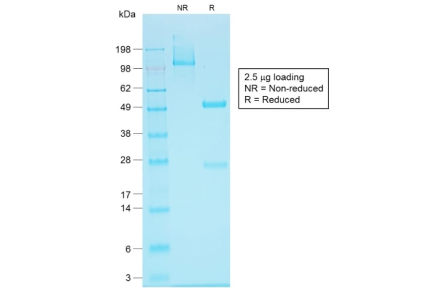 SDS-PAGE - Anti-EpCAM Antibody [EGP40/1555R] - BSA and Azide free (A249264) - Antibodies.com