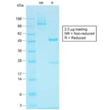 SDS-PAGE - Anti-EpCAM Antibody [EGP40/1555R] - BSA and Azide free (A249264) - Antibodies.com