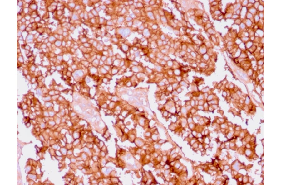 Immunohistochemistry - Anti-EpCAM Antibody [EGP40/1556R] - BSA and Azide free (A252445) - Antibodies.com
