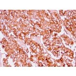 Immunohistochemistry - Anti-EpCAM Antibody [EGP40/1556R] - BSA and Azide free (A252445) - Antibodies.com