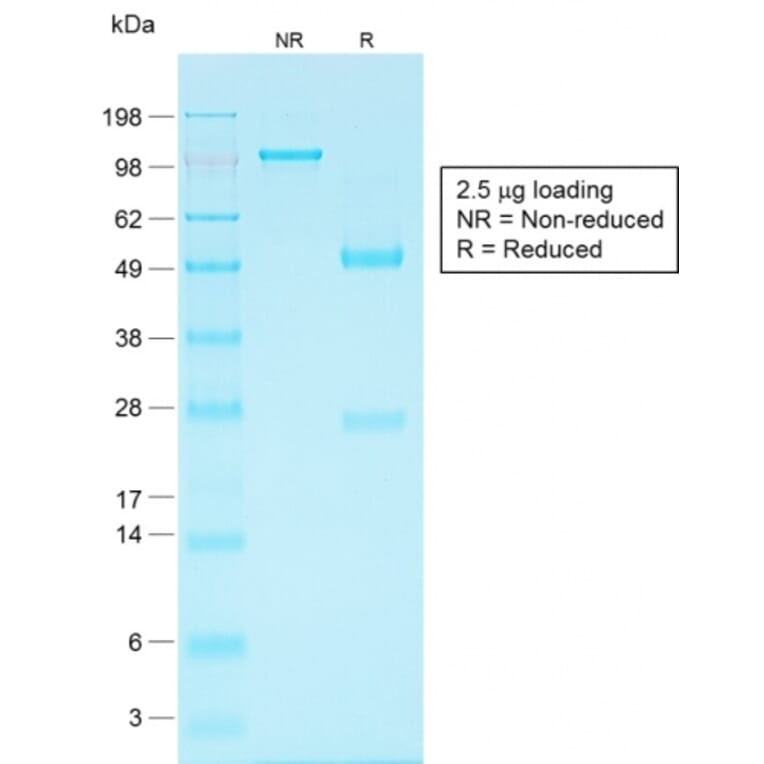 SDS-PAGE - Anti-EpCAM Antibody [EGP40/1556R] - BSA and Azide free (A252445) - Antibodies.com