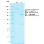 SDS-PAGE - Anti-EpCAM Antibody [EGP40/1556R] - BSA and Azide free (A252445) - Antibodies.com