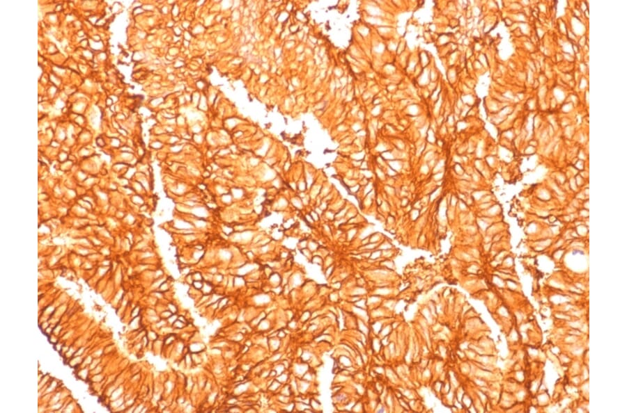 Immunohistochemistry - Anti-EpCAM Antibody [EGP40/1556R] - BSA and Azide free (A252445) - Antibodies.com