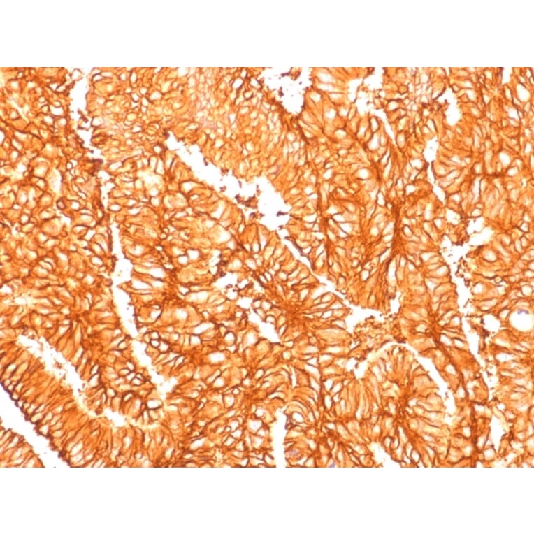 Immunohistochemistry - Anti-EpCAM Antibody [EGP40/1556R] - BSA and Azide free (A252445) - Antibodies.com