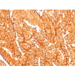 Immunohistochemistry - Anti-EpCAM Antibody [EGP40/1556R] - BSA and Azide free (A252445) - Antibodies.com