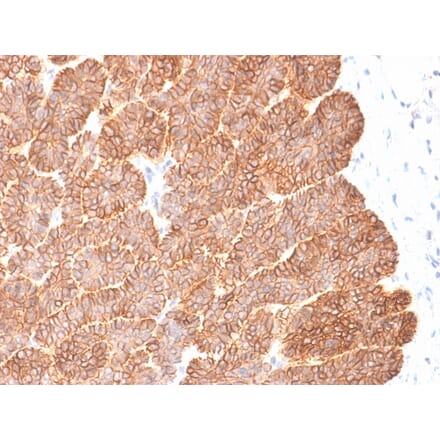 Immunohistochemistry - Anti-EpCAM Antibody [EGP40/2041R] - BSA and Azide free (A252445) - Antibodies.com