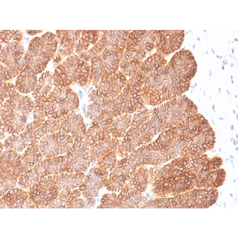 Immunohistochemistry - Anti-EpCAM Antibody [EGP40/2041R] - BSA and Azide free (A252445) - Antibodies.com