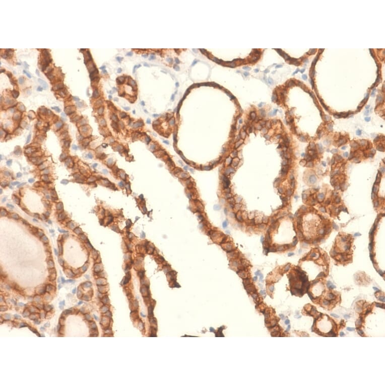Immunohistochemistry - Anti-EpCAM Antibody [EGP40/2041R] - BSA and Azide free (A252446) - Antibodies.com
