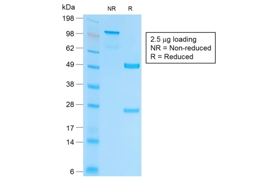 SDS-PAGE - Anti-EpCAM Antibody [EGP40/2041R] - BSA and Azide free (A252446) - Antibodies.com