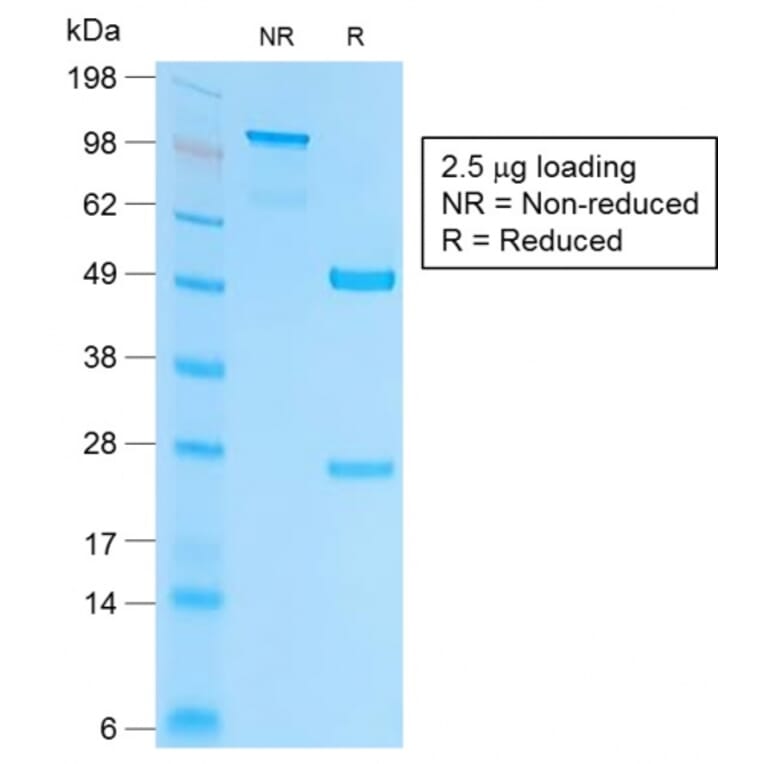 SDS-PAGE - Anti-EpCAM Antibody [EGP40/2041R] - BSA and Azide free (A252446) - Antibodies.com