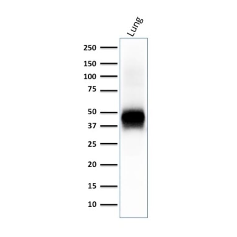 Western Blot - Anti-EpCAM Antibody [EGP40/2041R] - BSA and Azide free (A252446) - Antibodies.com