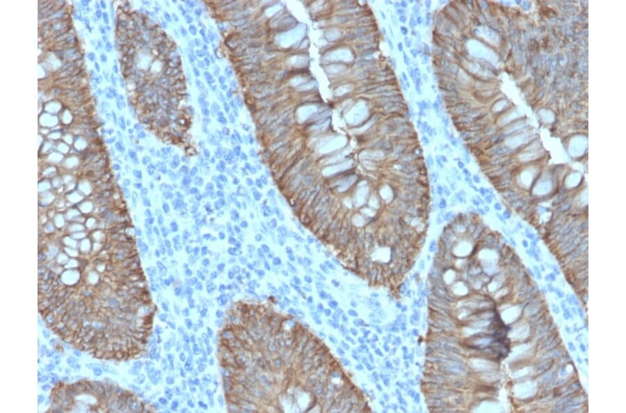 Immunohistochemistry - Anti-EpCAM Antibody [EGP40/2571R] - BSA and Azide free (A252447) - Antibodies.com