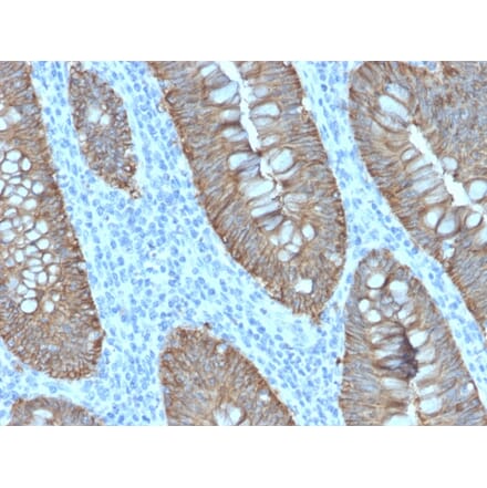Immunohistochemistry - Anti-EpCAM Antibody [EGP40/2571R] - BSA and Azide free (A252447) - Antibodies.com