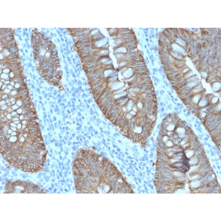 Immunohistochemistry - Anti-EpCAM Antibody [EGP40/2571R] - BSA and Azide free (A252447) - Antibodies.com