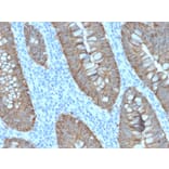 Immunohistochemistry - Anti-EpCAM Antibody [EGP40/2571R] - BSA and Azide free (A252447) - Antibodies.com