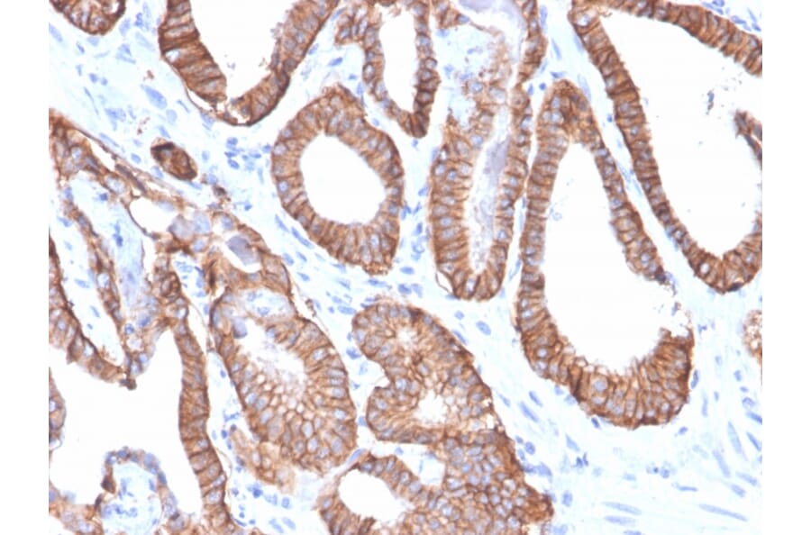 Immunohistochemistry - Anti-EpCAM Antibody [EGP40/2571R] - BSA and Azide free (A252447) - Antibodies.com