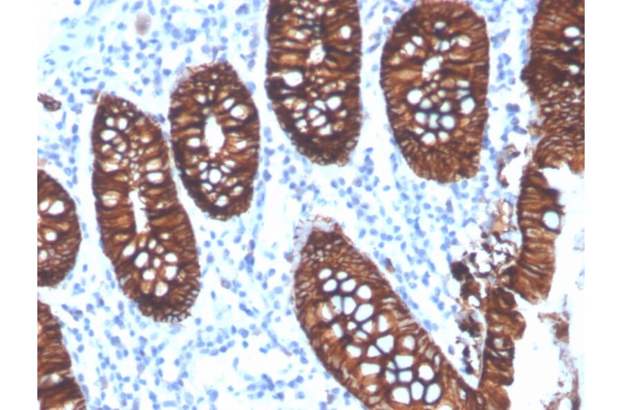 Immunohistochemistry - Anti-EpCAM Antibody [EGP40/4546R] - BSA and Azide free (A252447) - Antibodies.com