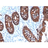 Immunohistochemistry - Anti-EpCAM Antibody [EGP40/4546R] - BSA and Azide free (A252447) - Antibodies.com