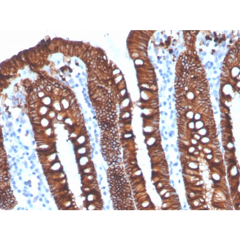 Immunohistochemistry - Anti-EpCAM Antibody [EGP40/4546R] - BSA and Azide free (A252448) - Antibodies.com