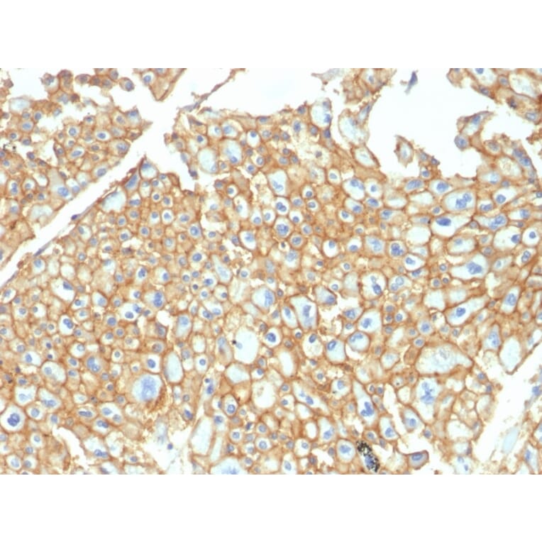 Immunohistochemistry - Anti-EpCAM Antibody - BSA and Azide free (A252449) - Antibodies.com