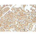 Immunohistochemistry - Anti-EpCAM Antibody - BSA and Azide free (A252449) - Antibodies.com