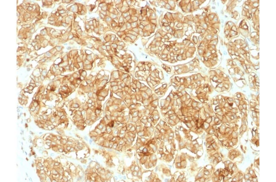 Immunohistochemistry - Anti-EpCAM Antibody - BSA and Azide free (A252448) - Antibodies.com