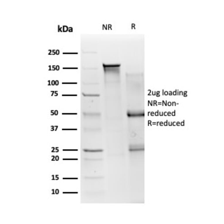 SDS-PAGE - Anti-SMAD3 Antibody [PCRP-SMAD3-1A2] - BSA and Azide free (A252450) - Antibodies.com