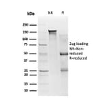 SDS-PAGE - Anti-SMAD3 Antibody [PCRP-SMAD3-1A2] - BSA and Azide free (A252450) - Antibodies.com