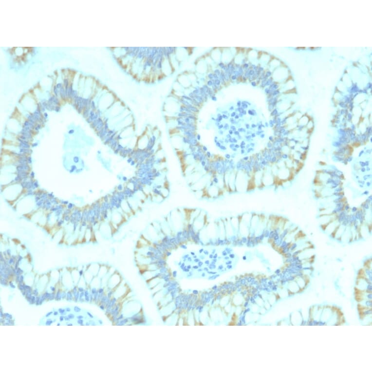 Immunohistochemistry - Anti-SMAD4 Antibody [SMAD4/2440] - BSA and Azide free (A252451) - Antibodies.com
